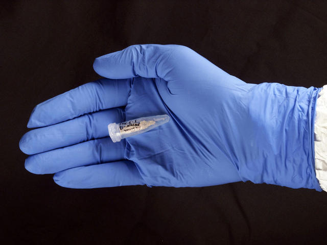 Una de las muestras de ADN analizadas Una de las muestras de ADN analizadas