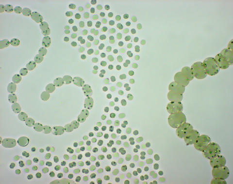 <p>Población de cianobacterias (<em>Anabaena spp.</em> y<em> Microcystis aeruginosa</em>). Imagen: Y. Ouahid.</p>