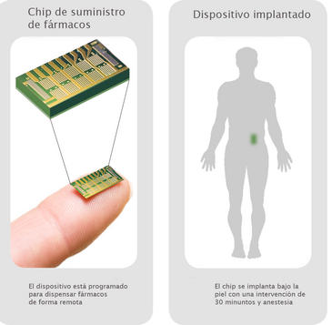 El dispositivo es programable de forma inalámbrica y puede activarse desde un ordenador o un teléfono móvil. Imagen: MicroCHIPS.
