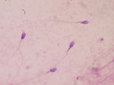 Espermatozoides humanos teñidos para examinar calidad seminal. Imagen: Bob J. Galindo
