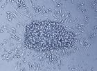 Colonia de células madres estudiadas en esta investigación. Imagen: RECAVA.
