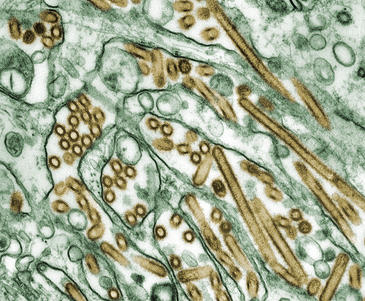 Cuestionan los datos de la OMS sobre prevalencia y mortalidad de la gripe aviar