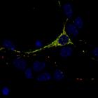 En la foto, una neurona cerebral en cultivo. Imagen: IRB Barcelona. 