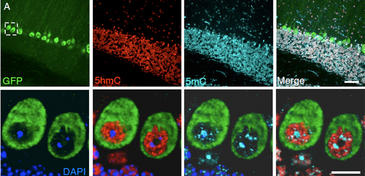 La proporción entre ambas variantes de la citosina en el ADN puede estar detrás del síndrome de Rett. Imagen: Cell 
