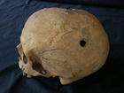 Cráneo trepanado. Imagen: Esther Gómez López.  
