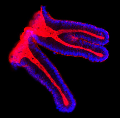 <p>Células epiteliales de colon. Imagen: IRB</p>