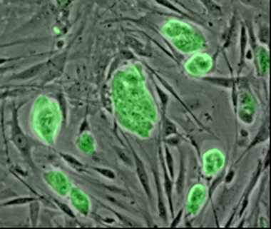 <p>Células madre de ratón, teñidas de verde. Imagen:<a href="http://commons.wikimedia.org/wiki/File:Mouse_embryonic_stem_cells.jpg?uselang=es" target="_blank"> Wikipedia</a></p>