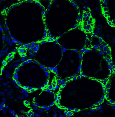 <p>Tinción de yodo (verde) expresado por los folículos tiroideos obtenidos in vitro a partir de células madre embrionarias de ratón. Imagen: S. Costagliola</p>