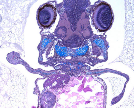<p>Embrión de pez cebra, que desarrolló miembros más parecidos a patas que a aletas después de ser manipulado para que produjera la proteina HoxD13. Imagen: Freitas et al., Developmental Cell.</p>
