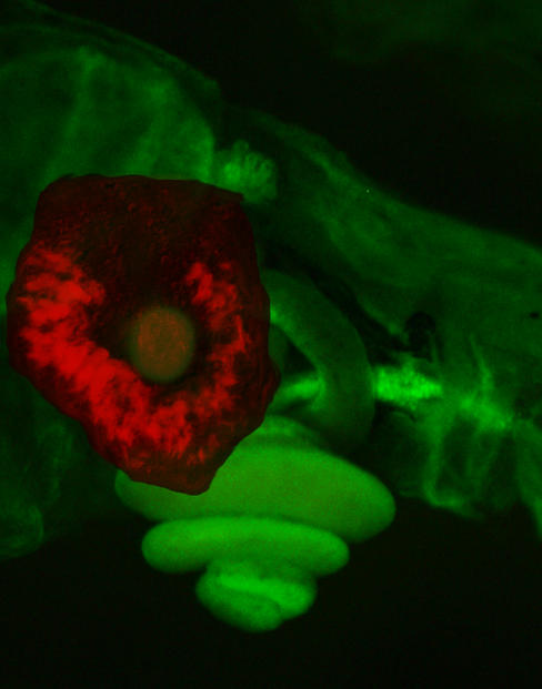  Identifican una causa molecular de la predisposición a sufrir cáncer de colon