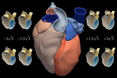 <p>An atlas of the human heart is drawn using statistics</p>