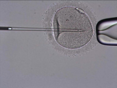 <p>En la fecundación in vitro la fertilización de los ovocitos por los espermatozoides se realiza fuera del cuerpo de la madre. Imagen: Tahe.</p>