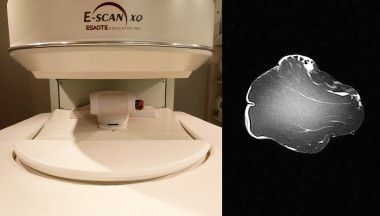 <p>The quality of a loin can be predicted by inserting it into an MRI scanner and analyzing its magnetic resonance image. / TECAL-GIM (UEx)</p>