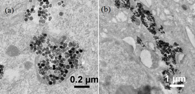 <p>Imágenes de (a) nanopartículas internalizadas en células cancerosas tras incubación durante 24 horas, y (b) agregados de nanopartículas tras aplicar posteriormente un campo magnético de baja magnitud. / Y. Sheng, C. Wu, Y. Cheng, G.R. Plaza</p>