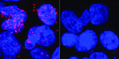 En la imagen de la izquierda se muestran en rojo las interacciones entre la proteína receptor de andrógenos (AR) y la proteína TFIIF, nueva diana terapéutica para el tratamiento del cáncer de próstata avanzado. En la de la derecha no se registran interacciones, tras eliminar la región del AR donde se une TFIIF. / Paula Martínez-Cristóbal, IRB Barcelona