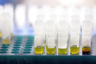 Comienzan a sistematizar los contaminantes químicos en los alimentos 