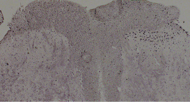 <p>Spinal cord. / Jose Vicente Torres.</p>