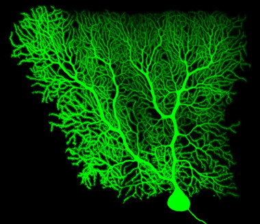 La investigación del Instituto de Neurociencias de Castilla y León demuestra que el citoesqueleto de las células de Purkinje (en la imagen) es clave para que el cerebelo pierda sus funciones