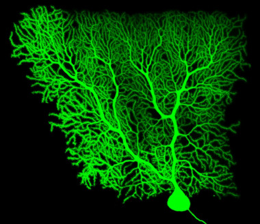 <p>La investigación del Instituto de Neurociencias de Castilla y León demuestra que el citoesqueleto de las células de Purkinje (en la imagen) es clave para que el cerebelo pierda sus funciones. / INCYL</p>