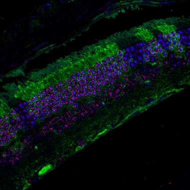 <p>Imagen del ojo que muestra en verde las células con telómeros hiperlargos y en rojo los telómeros. / CNIO</p>