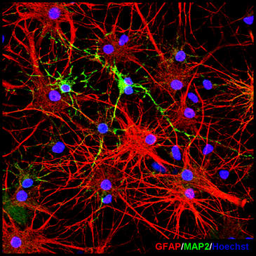 Crean un molde para nuevas piezas del puzzle neuronal