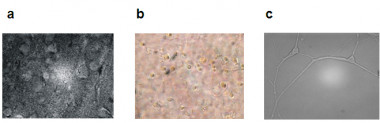 <p>Preparación del tejido cerebral humano tras la cirugía (a), disociado de las células a tiempo cero (b) y neurona de corteza de cerebro humano después de un mes de cultivo.Imagen: UAM</p>