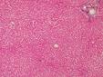 Virus de la hepatitis C