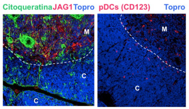 Expresión de Notch Jagged1 en la región medular del timo humano. Izda.: Distribución de Notch Jagged1 (rojo) y de células epiteliales tímicas (verde) en región medular (M) y cortical (C) de timo humano. Dcha.: Localización anatómica de células dendríticas (rojo). / UAM