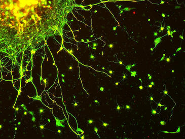 Descifran las claves del ajuste de las neuronas al tamaño corporal