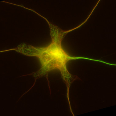 <p>Imagen de microscopía de una neurona de ratón en cultivo con la red de microtúbulos en verde y rojo, según modificaciones químicas. El axón, en verde más intenso, es la extensión nerviosa que tiene más cantidad de microtúbulos modificados. / Carlos Sánchez-Huertas, IRB Barcelona</p>