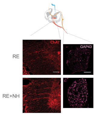 Los análisis de la zona ventral de la médula espinal y del nervio ciático (esquema indicando las zonas) por microscopia confocal muestran claramente que el modelo de reimplante (RE) tratado con NeuroHeal (NH) presenta más ramificaciones axonales motoras (ChAT positivas, color rojo) que regeneran (GAP43 positivas, color magenta) que los animales sin tratamiento. / UAB