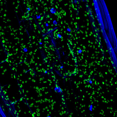 <p>Imagen microscópica de células del tallo de la plántula Arabidopsis thaliana. En verde se observan los cloroplastos y en azul los núcleos de las células. / CRAG</p>