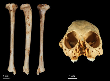 <p>Huesos y cráneo de <em>Antillothrix Bernensis<strong> </strong></em>/ <em>Journal of Human Evolution</em></p>