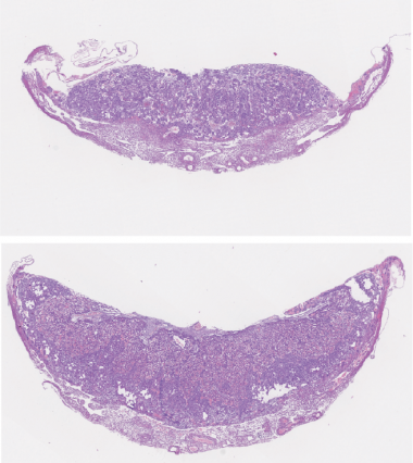 Día 12,5 de desarrollo embrionario. El desarrollo de la placenta es defectuoso en ausencia de TLK2 (imagen superior). / S. Segura-Bayona, IRB Barcelona