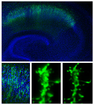 Panel superior e inferior izquierdo: expresión de receptores de neurotransmisor marcados fluorescentemente (verde) en secciones de hipocampo, la zona del cerebro implicada en la formación de memorias. Panel inferior, centro y derecha: detalle morfológico de las conexiones sinápticas entre neuronas. La inserción de nuevos receptores de neurotransmisor en estas conexiones es un mecanismo fundamental para el aprendizaje y la memoria. Panel superior e inferior izquierdo: expresión de receptores de neurotransmisor marcados fluorescentemente (verde) en secciones de hipocampo, la zona del cerebro implicada en la formación de memorias. Panel inferior, centro y derecha: detalle morfológico de las conexiones sinápticas entre neuronas. La inserción de nuevos receptores de neurotransmisor en estas conexiones es un mecanismo fundamental para el aprendizaje y la memoria.
