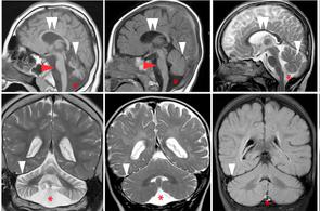 Conexiones neuronales del cerebro humano. / Connectome