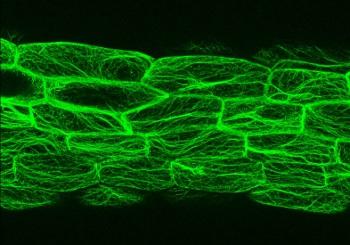 Citoesqueleto de Arabidopsis / Antonio Leyva 