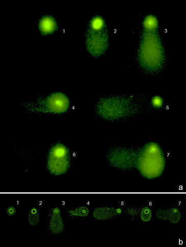 Detectan los daños genéticos de los espermatozoides humanos