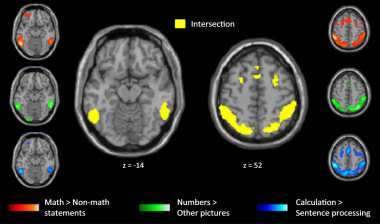 <p>Las imágenes por resonancia magnética funcional han servido para detectar las zonas que se activaban en matemáticos y personas que no lo eran frante a enunciados matemáticos de alto nivel. / M.Amalric y S.Dehaene/Inserm-CEA</p>