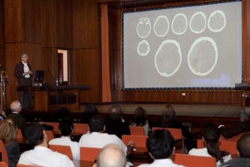 Diagnosticar un ictus en las tres primeras horas evitará discapacidades en personas con infarto cerebral