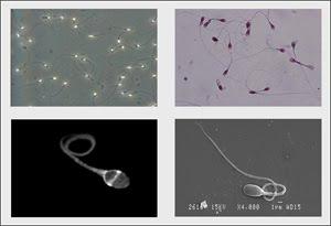 Imágenes de espermatozoides. / UA