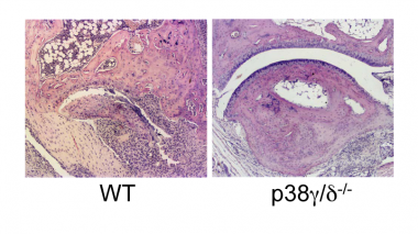 <p>Los ratones que carecen de p38γ/δ están protegidos frente al daño articular en un modelo de artritis. / A. Cuenda, CNB-CSIC</p>