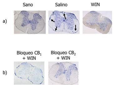 Figura Cannabinoides Figura Cannabinoides