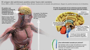 <p>¿Comienza el párkinson en el intestino? Es la hipótesis del médico alemán Braak, que se explica en esta infografía. / José Antonio Peñas (Sinc)</p>