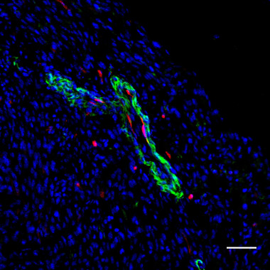 <p>Vaso sanguíneo del corazón con células derivadas de Bmi1 en rojo, células del musculo liso en verde y nucleos en azul. / Antonio Bernad, CNB-CSIC</p>