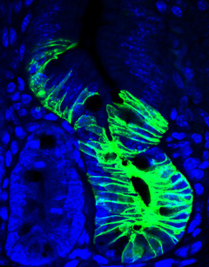 <p>Después de la quimioterapia, las células quiescentes cambian su comportamiento, se activan y regeneran todos los tipos celulares en el intestino (en verde). / F. Barriga, IRB Barcelona</p>