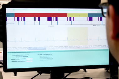 <p>Los investigadores han conseguido corregir uno de los problemas clásicos en el ámbito de la e-Salud y el electrocardiograma: el ‘ruido’ / CiTIUS</p>