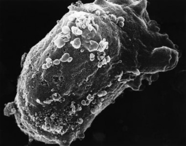 <p>Vista al microscopio electrónico de un linfocito con VIH. / <a href="https://visualsonline.cancer.gov/details.cfm?imageid=1833" target="_blank">National Cancer Institute</a></p>