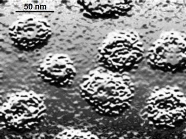 El virus del papiloma humano es más persistente en mujeres infectadas por el VIH 