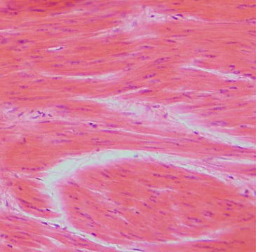 Establecen la relación entre el estrés oxidativo y la pérdida de masa muscular